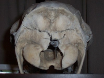 back of skull.jpg